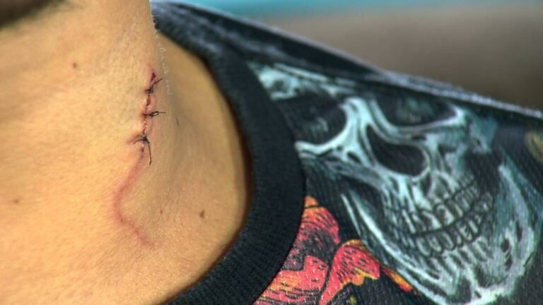 Mulher é esfaqueada pela companheira durante bebedeira em condomínio