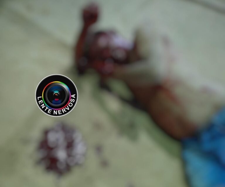 Homem é brutalmente agredido no Orgulho do Madeira