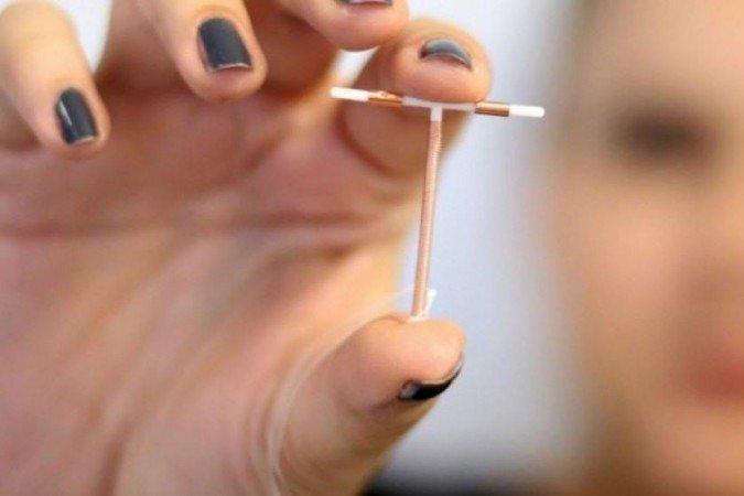 Plano de saúde exige consentimento do marido para colocar DIU em mulher Plano de saúde exige consentimento do marido para colocar DIU em mulher