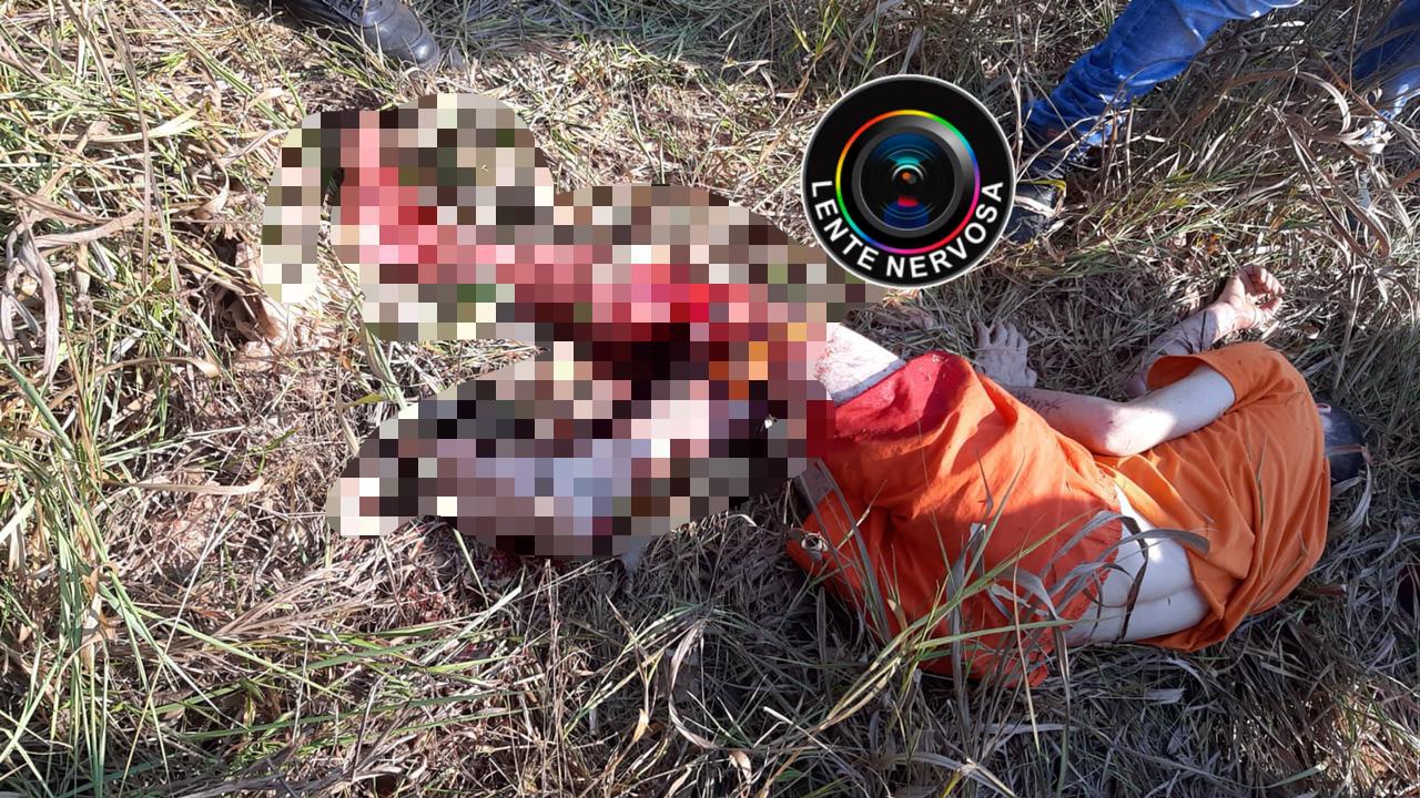 Presidiário tem perna dilacerada ao tentar fugir de cadeia em Porto Velho Presidiário tem perna dilacerada ao tentar fugir de cadeia em Porto Velho