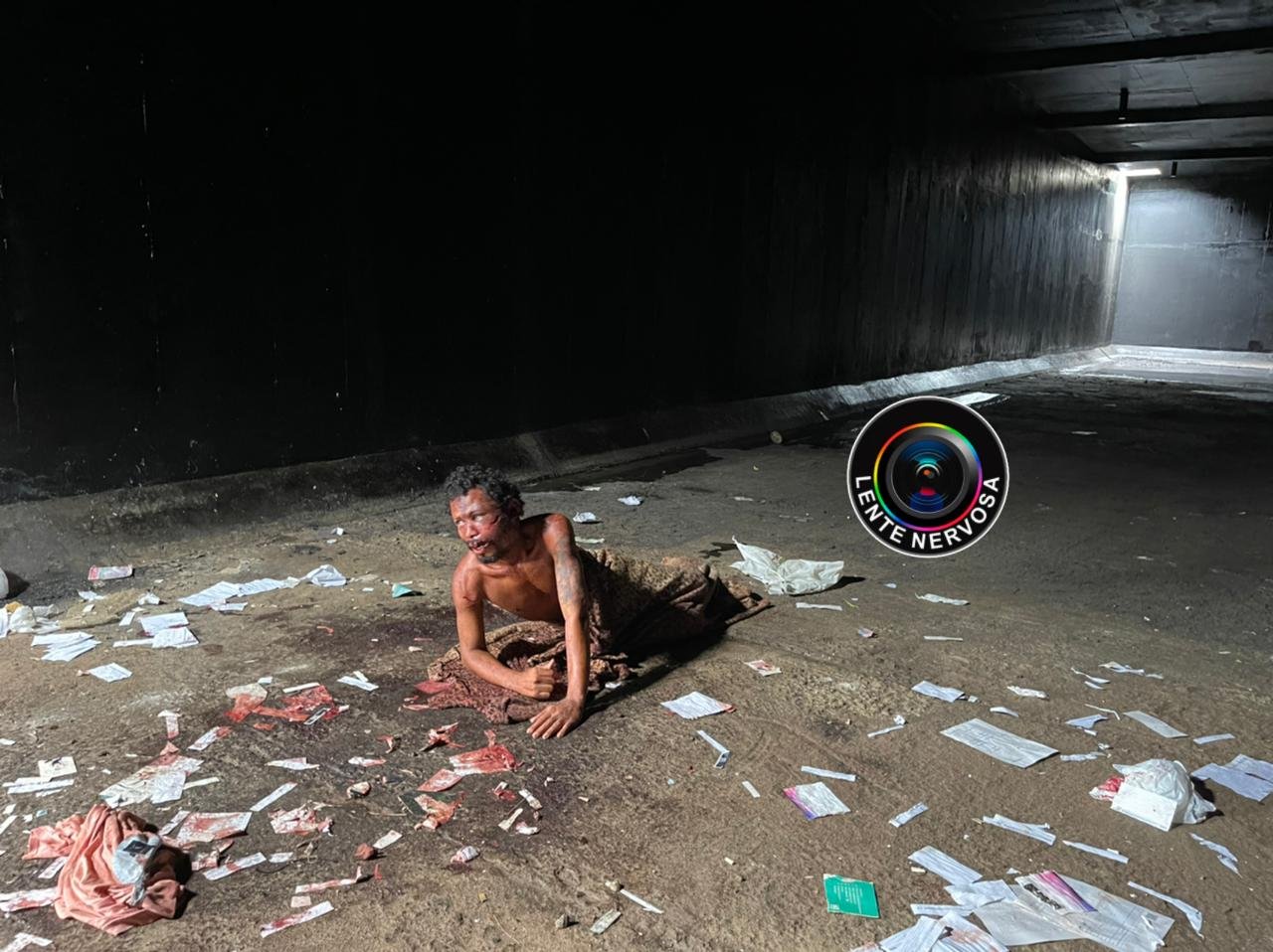 LENTE URGENTE - Morador em situação de rua é espancado na zona sul 2 LENTE URGENTE - Morador em situação de rua é espancado na zona sul