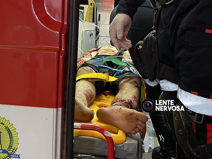 ATUALIZADA – VÍDEO: homem é encontrado com múltiplas fraturas na BR-364 e polícia suspeita de atropelamento