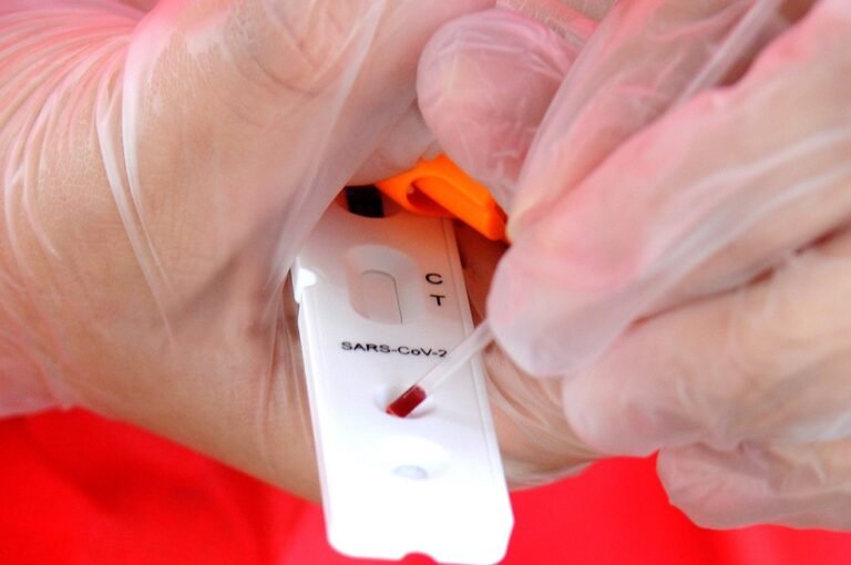 Boletim Covid: Rondônia registra 90 novos casos e nenhuma morte nesta segunda-feira (1°)