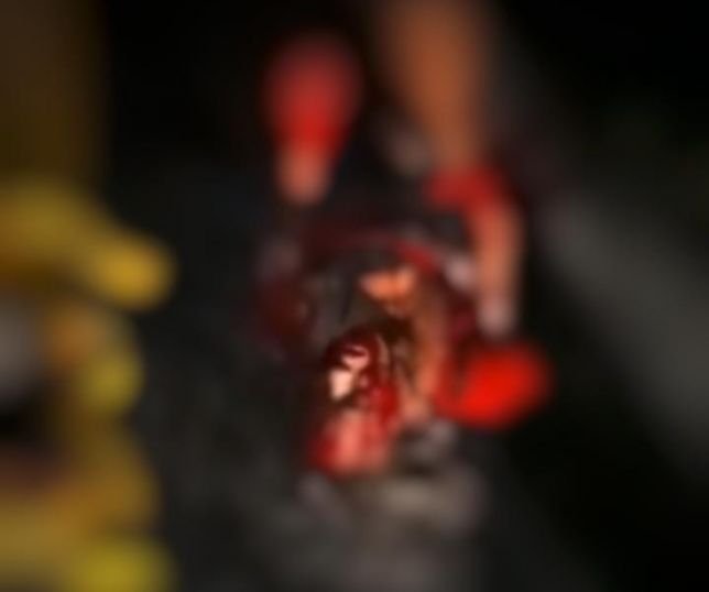 Jovem embriagada fica gravemente ferida após dirigir motocicleta e bater em poste