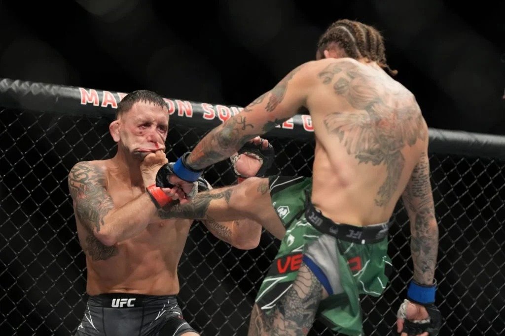 Lutador fica irreconhecível ao receber chute em nocaute no UFC
