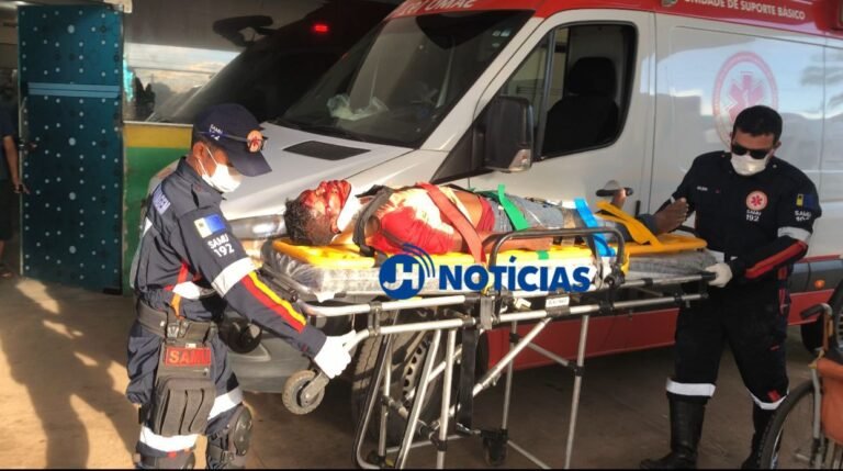 Roda de bicicleta é arrancada e ciclista fica gravemente ferido em atropelamento na zona sul