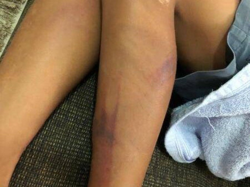 Homem espanca o próprio filho que não fez almoço e morre ao apontar arma de brinquedo a policiais