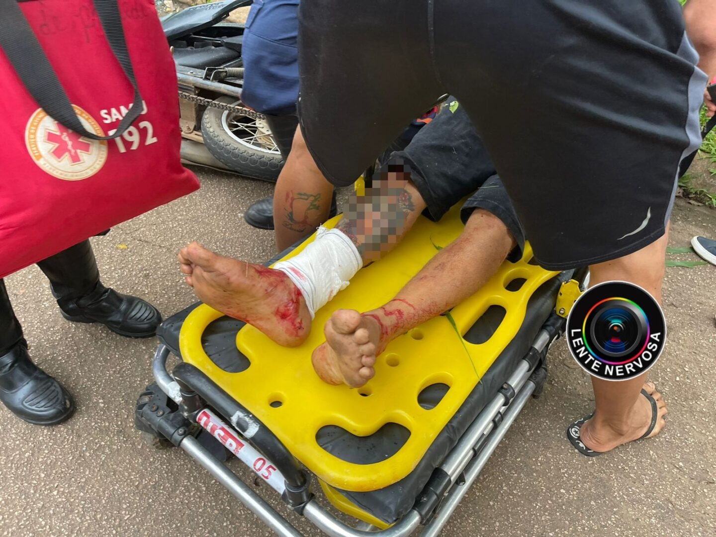 Motoqueiro fica gravemente ferido ao colidir em carro estacionado na zona sul