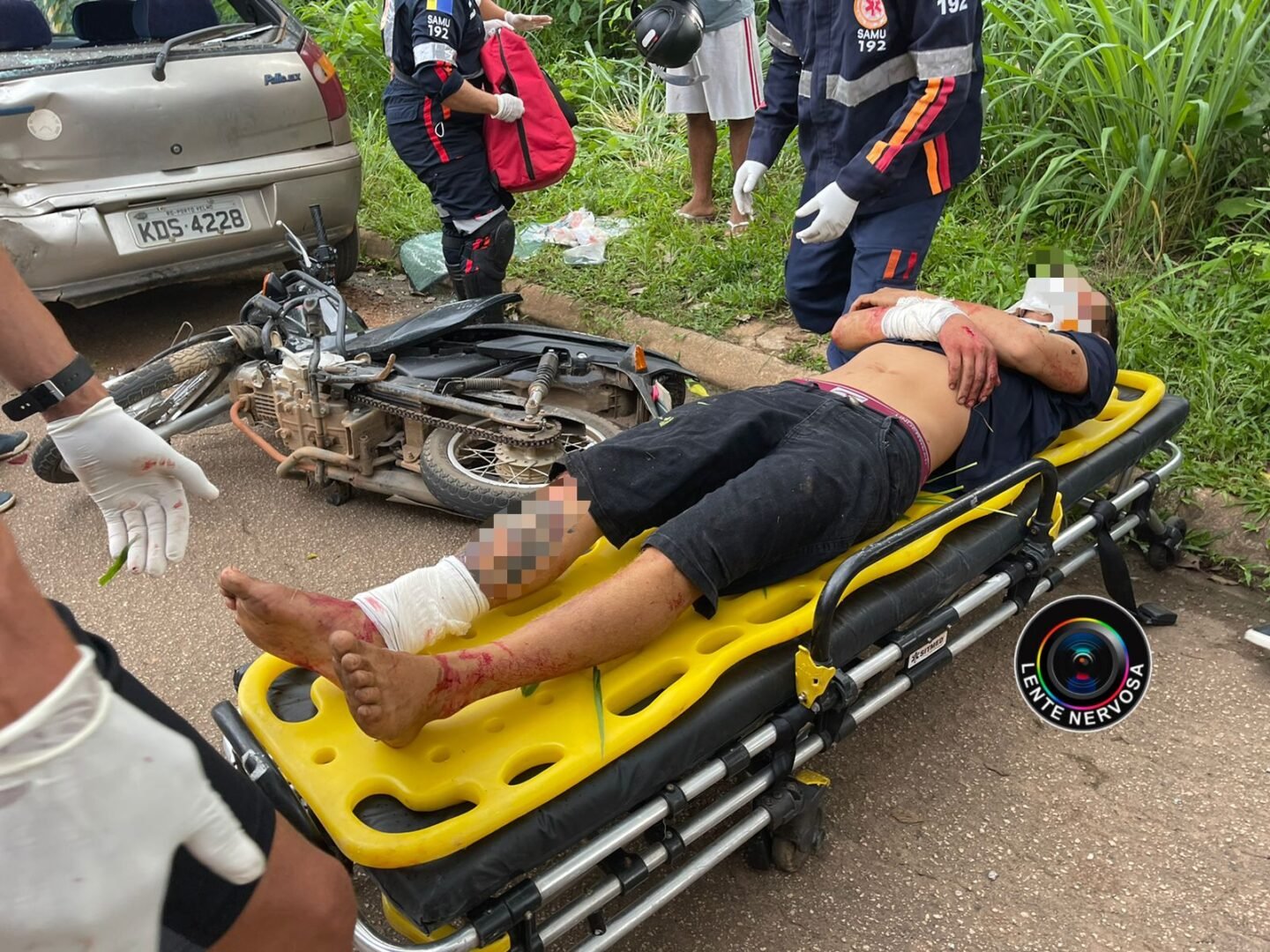 Motoqueiro fica gravemente ferido ao colidir em carro estacionado na zona sul