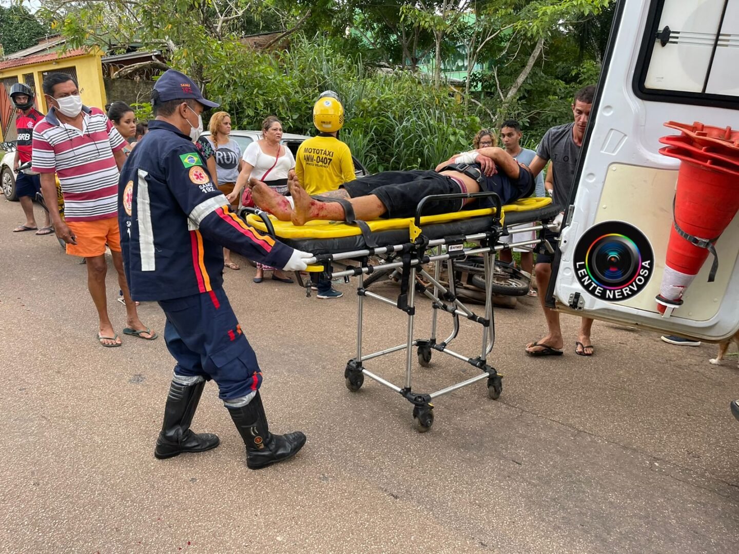 Motoqueiro fica gravemente ferido ao colidir em carro estacionado na zona sul