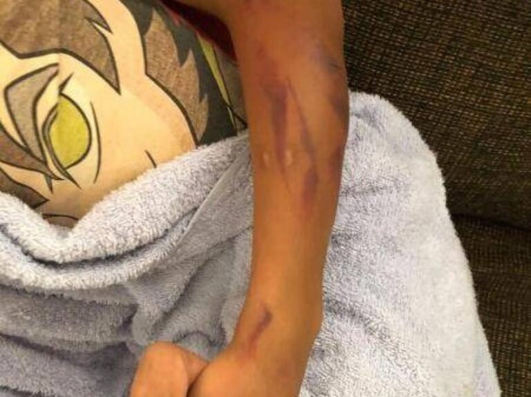 Homem espanca o próprio filho que não fez almoço e morre ao apontar arma de brinquedo a policiais