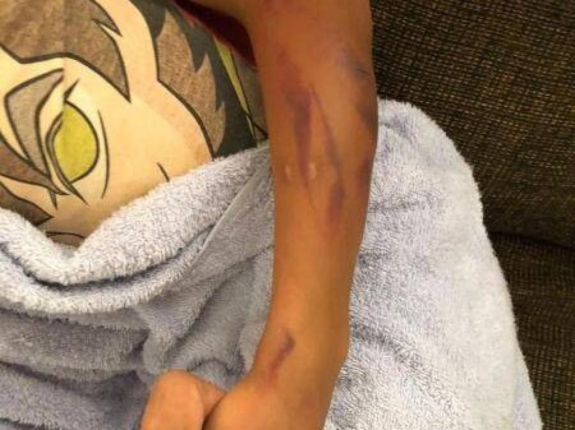 Homem espanca o próprio filho que não fez almoço e morre ao apontar arma de brinquedo a policiais