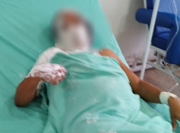 BÁRBARO – Filho ateia fogo na mãe grávida após ela se recusar a lavar roupa
