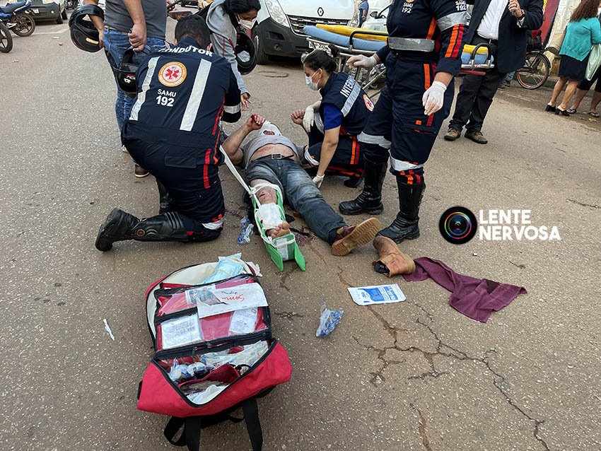 Colisão de motocicletas resulta em piloto gravemente ferido na zona sul