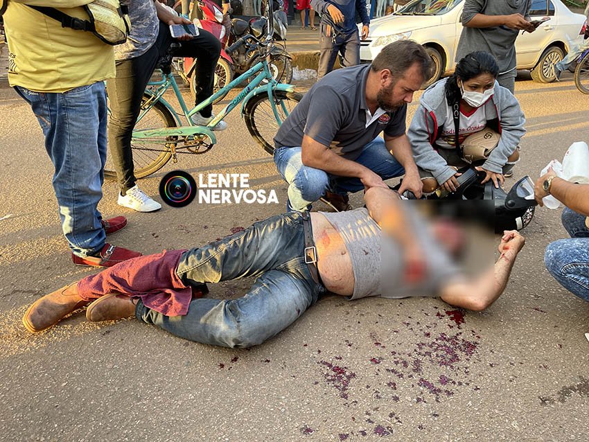 Colisão de motocicletas resulta em piloto gravemente ferido na zona sul