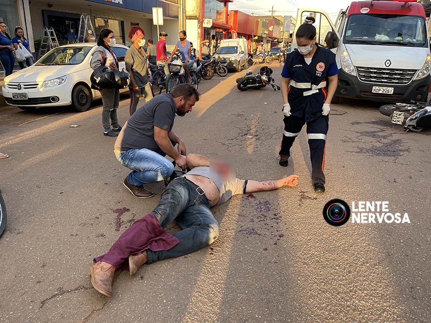 Colisão de motocicletas resulta em piloto gravemente ferido na zona sul