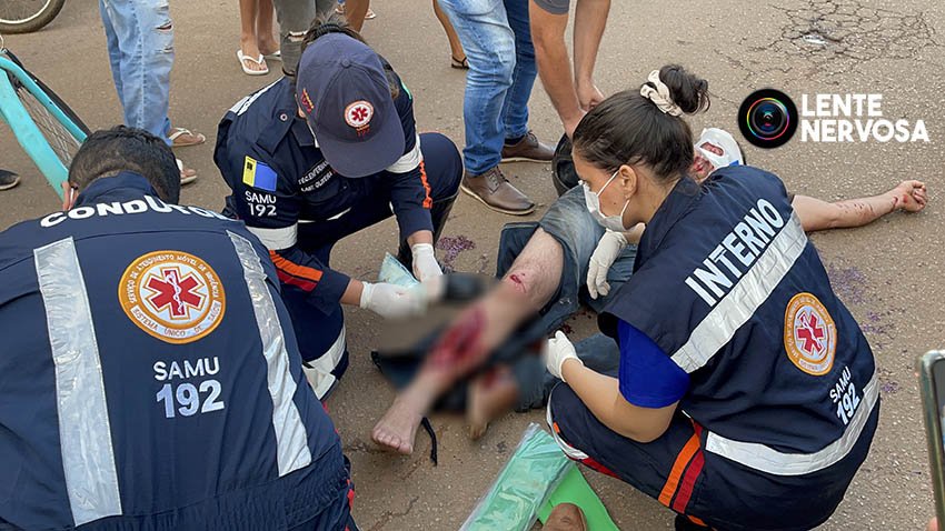 Colisão de motocicletas resulta em piloto gravemente ferido na zona sul