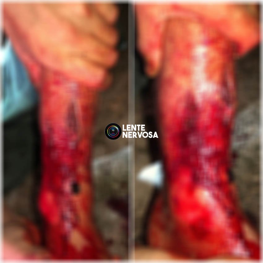 Adolescente com arma de brinquedo tenta assaltar policial penal e é baleado