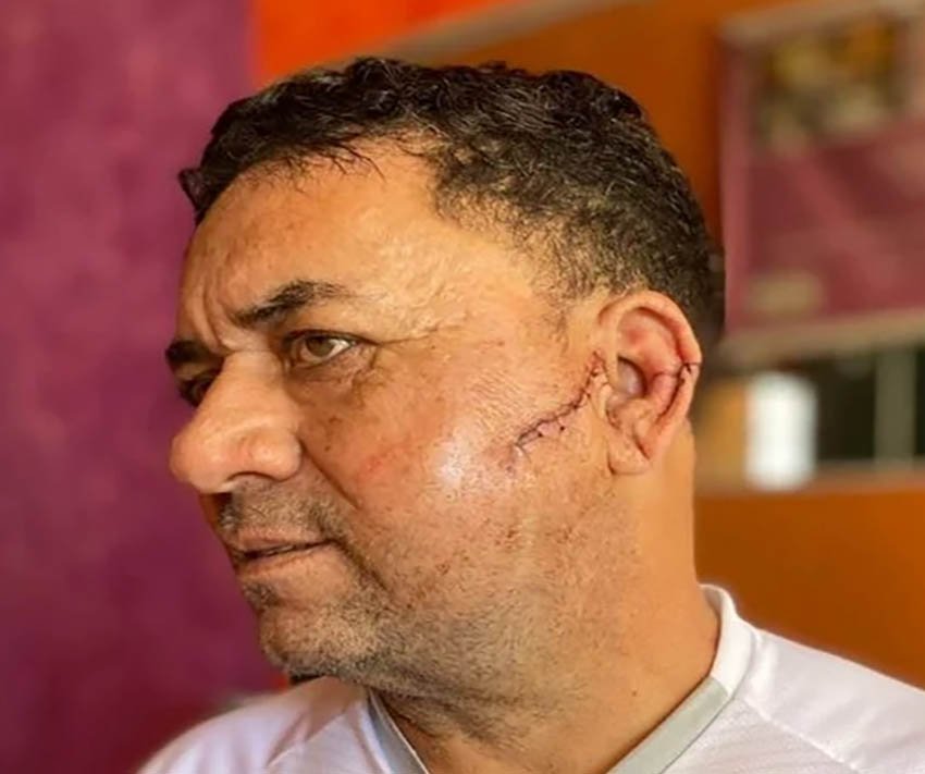 “Passei a acreditar em milagres”, diz sobrevivente de ataque com foice no DF