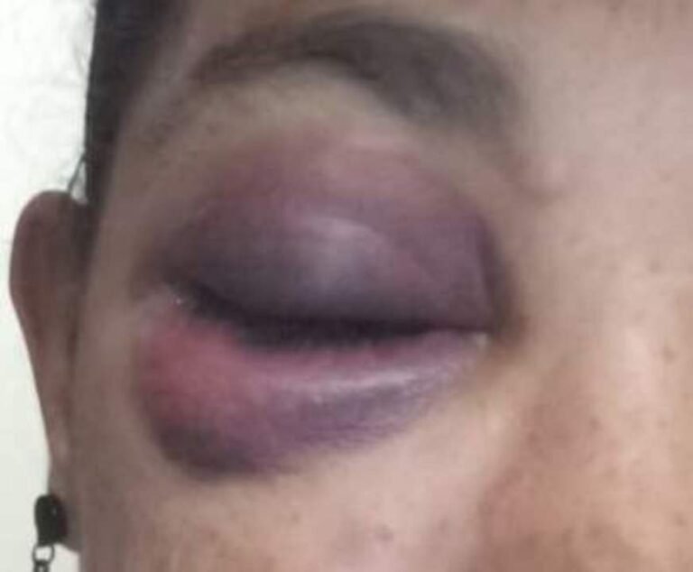 Homem é preso após dar soco no olho do filho de 14 anos