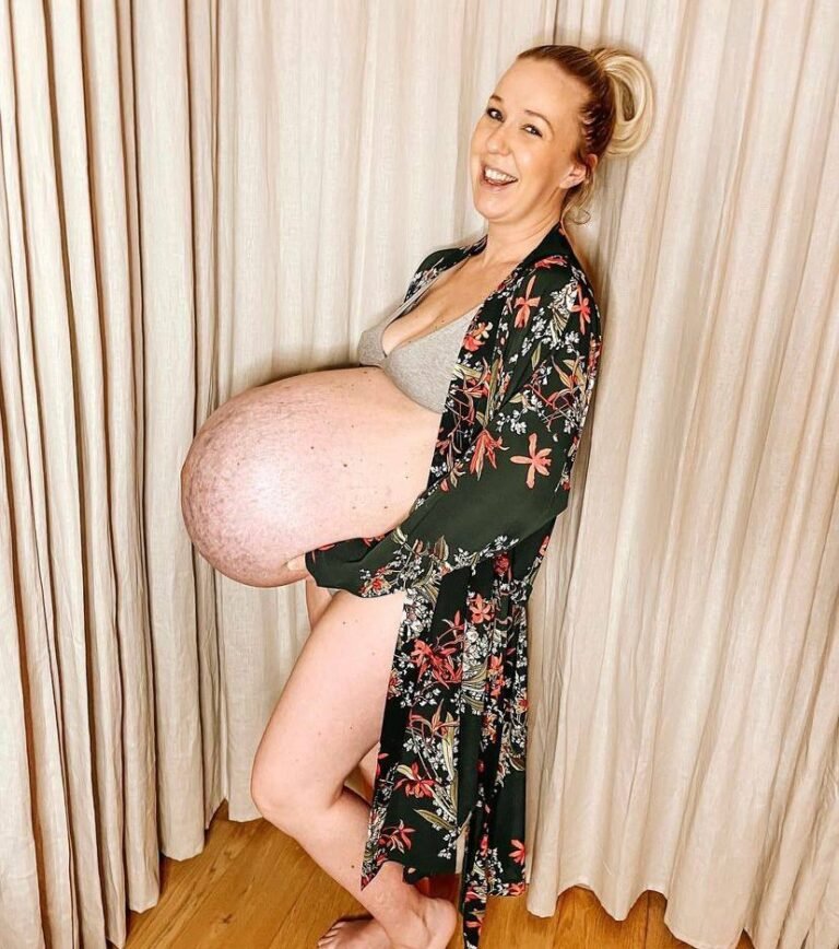 Formato da barriga de influencer grávida chama atenção na web; entenda