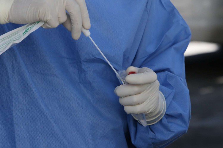 Rondônia registra 1.711 novos casos de Covid-19 e três óbitos nas últimas 24h