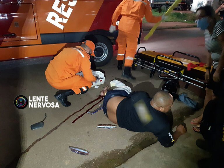 Acidente na zona sul resulta em motociclista com fratura exposta na perna