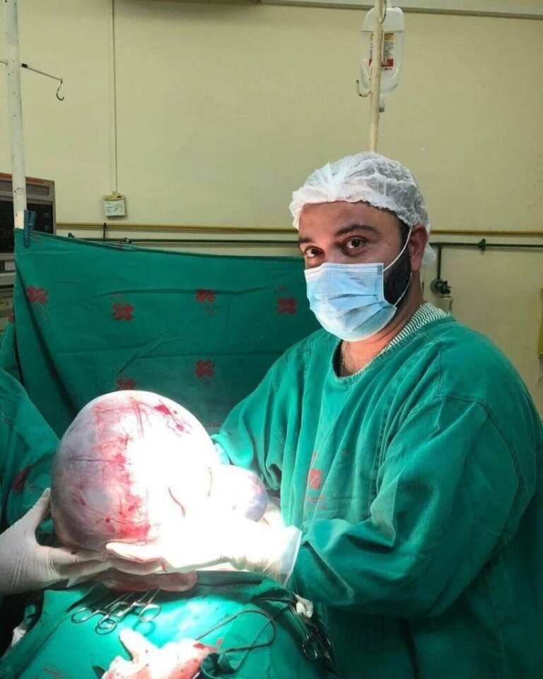 Idosa retira cisto gigante de 10 kg no norte do Rio; veja fotos