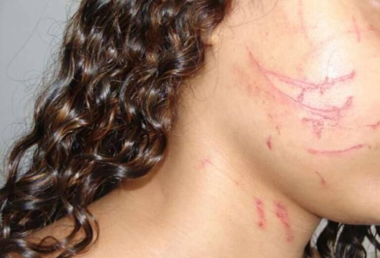 Tias de garota espancada por vereador em RO formalizam denúncia na Câmara