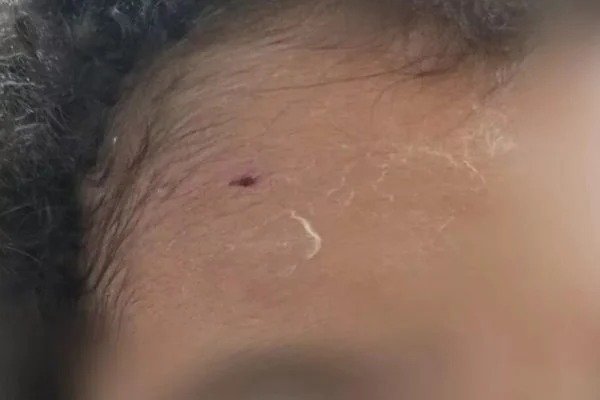 Pit-bull sem coleira ataca mãe e criança em shopping no interior de SP