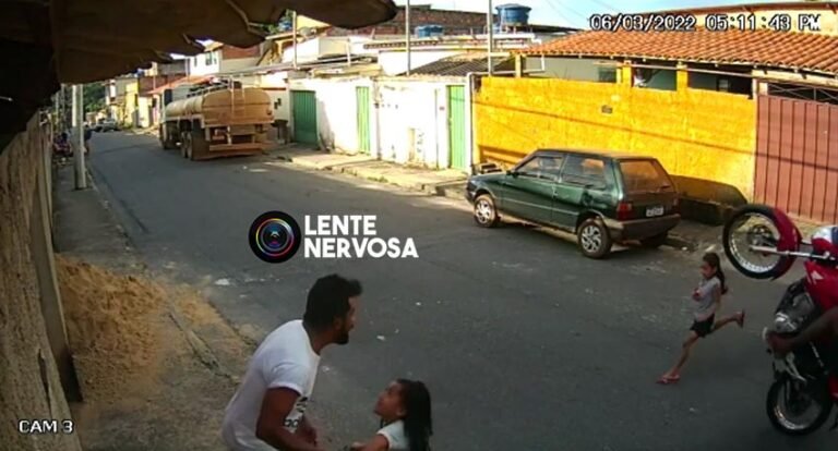 IMAGENS FORTES – Criança quebra a perna ao ser atropelada por homem que empinava moto, em BH