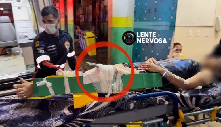 Criança fica com faca cravada no joelho ao ser atacada pelo padrasto; mãe também foi esfaqueada – VÍDEO