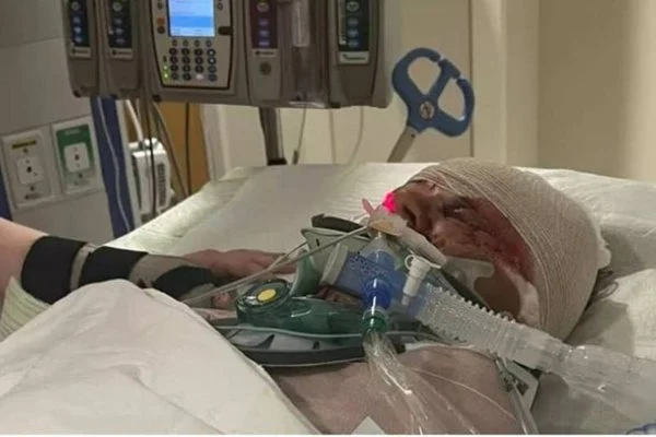 Mulher tem braços amputados após ataque de pit-bulls nos EUA