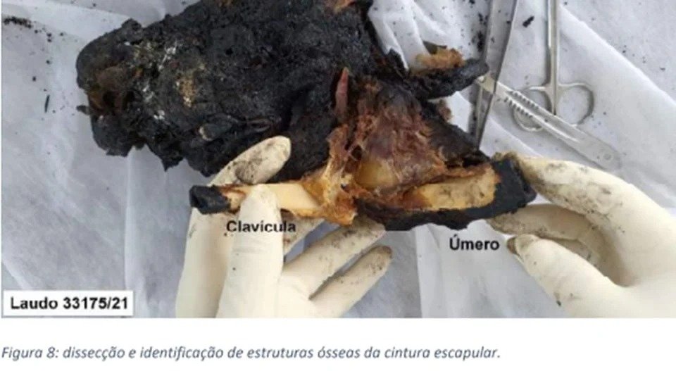 IMAGENS FORTES - Carbonizado, corpo de homem morto em ritual foi separado em 419 partes