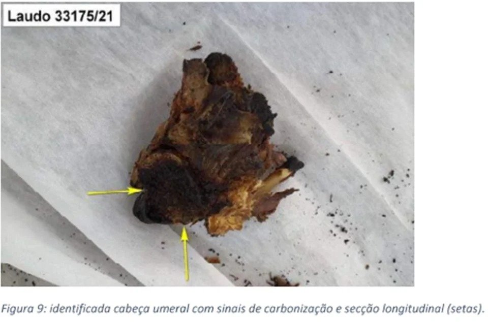 IMAGENS FORTES - Carbonizado, corpo de homem morto em ritual foi separado em 419 partes