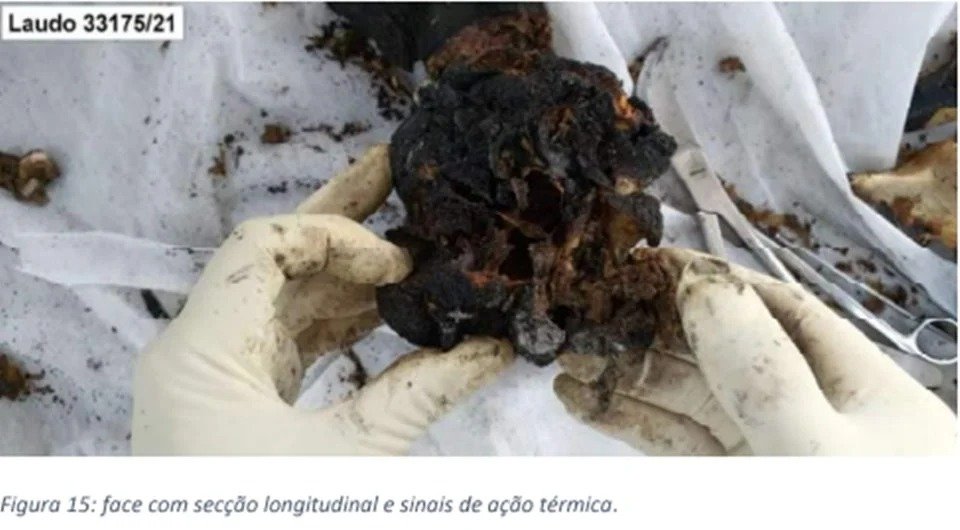 IMAGENS FORTES - Carbonizado, corpo de homem morto em ritual foi separado em 419 partes