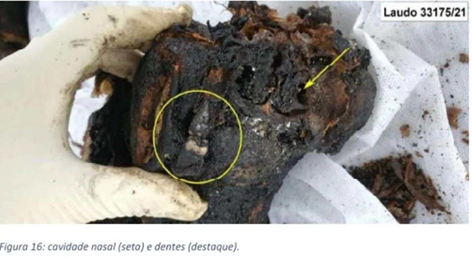 IMAGENS FORTES - Carbonizado, corpo de homem morto em ritual foi separado em 419 partes