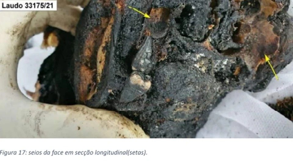 IMAGENS FORTES - Carbonizado, corpo de homem morto em ritual foi separado em 419 partes