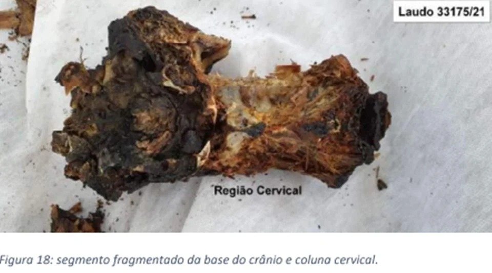 IMAGENS FORTES - Carbonizado, corpo de homem morto em ritual foi separado em 419 partes