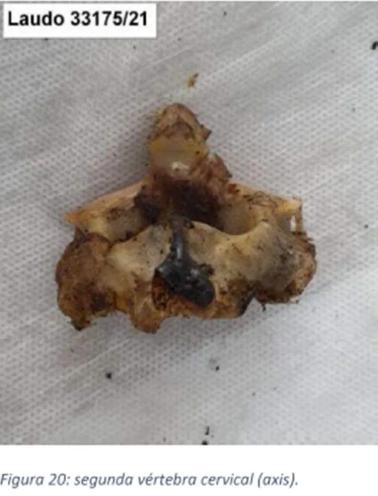 IMAGENS FORTES - Carbonizado, corpo de homem morto em ritual foi separado em 419 partes