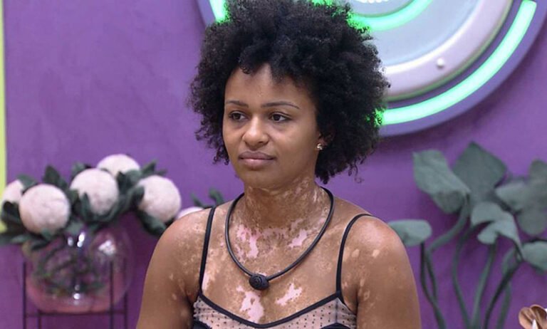 BBB22: Natália é alvo de ataques preconceituosos por conta de vitiligo