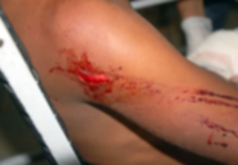 Últimas Notícias 2 Adolescente esfaqueia padrasto que agredia sua mãe