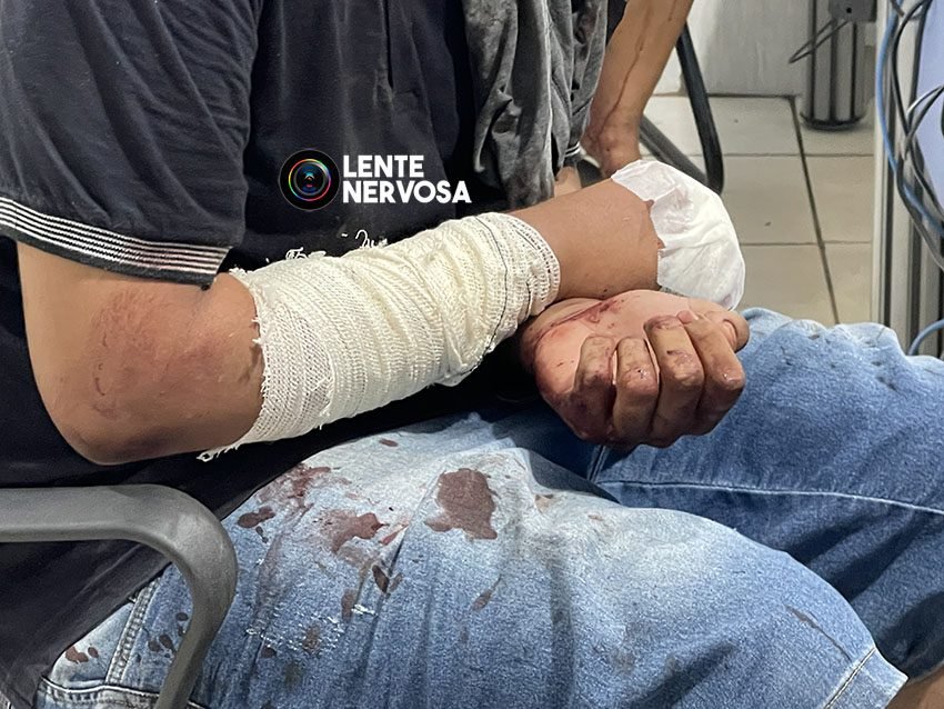 Adolescente agride mãe com pedrada e esfaqueia amigo durante bebedeira