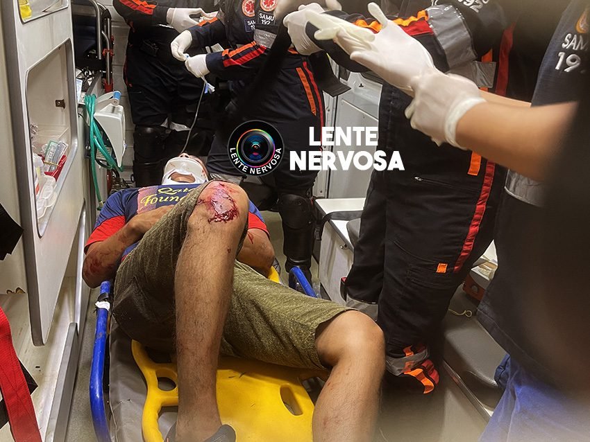 Vídeo: Motoqueiro sofre traumatismo craniano ao passar direto em avenida e invadir lanchonete