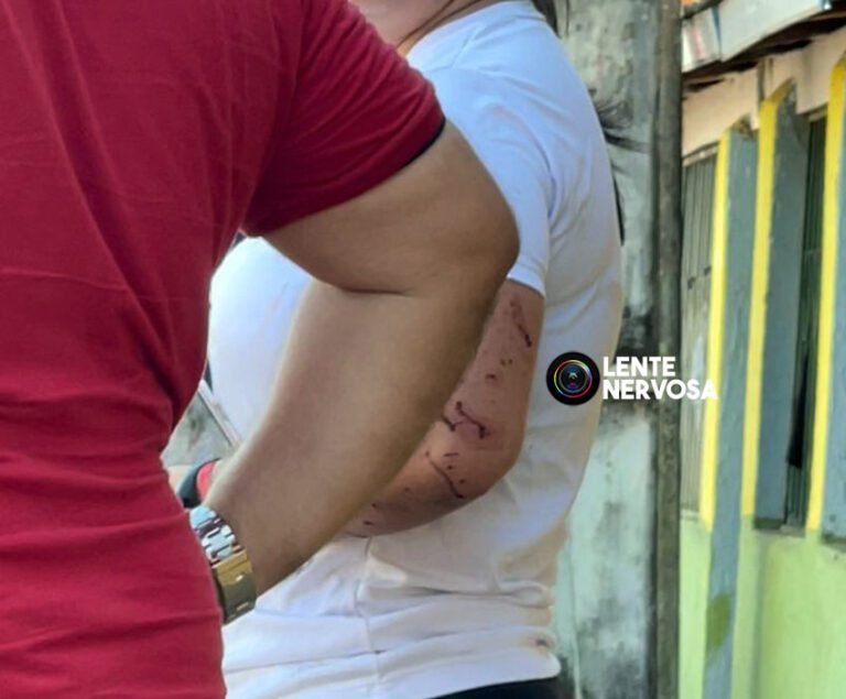 Últimas Notícias 1 “Não sei quem possa ter tentado me matar”, diz mulher alvo de ataque a tiros na capital – VÍDEO