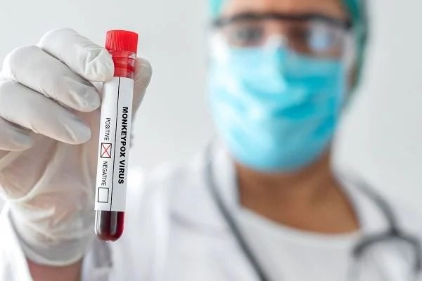 Ministério da Saúde confirma 6º caso de varíola dos macacos no Brasil