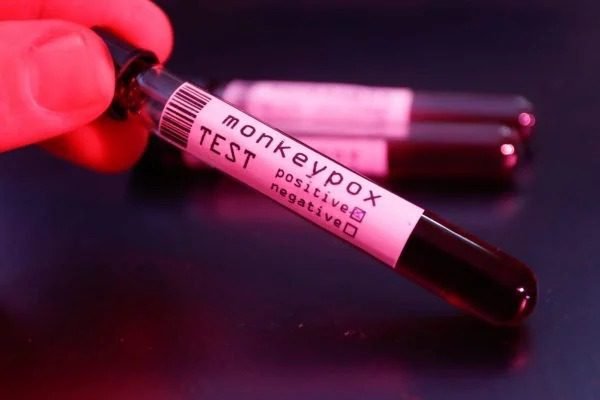 Sem vacina, Brasil se aproxima dos 4 mil casos de varíola dos macacos