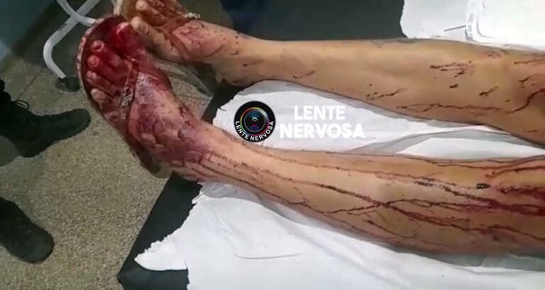 CIÚMES – Mulher é esfaqueada pela namorada enquanto dormia