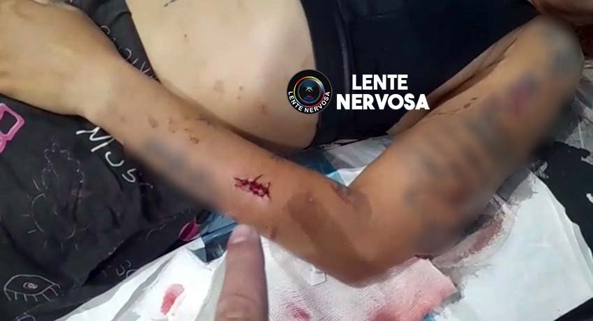 CIÚMES – Mulher é esfaqueada pela namorada enquanto dormia