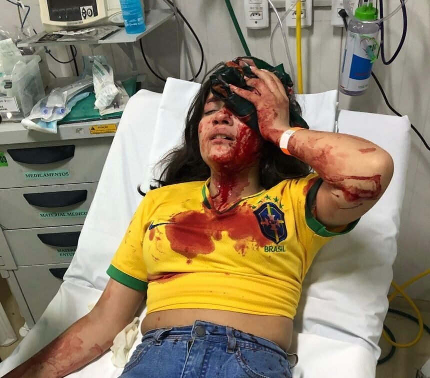 Adolescente de 13 anos é atingida por pedra em carreata do Bolsonaro